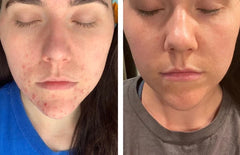 Beef Tallow Moisturizing Face Cream