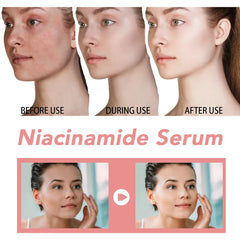 Niacinamide & Hyaluronic Acid Serum 30ml