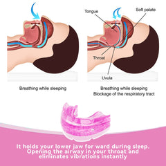 Anti-Snore Bruxism Mouth Guard