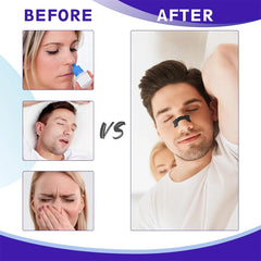 Black Nose Strips 30/60/90PCS